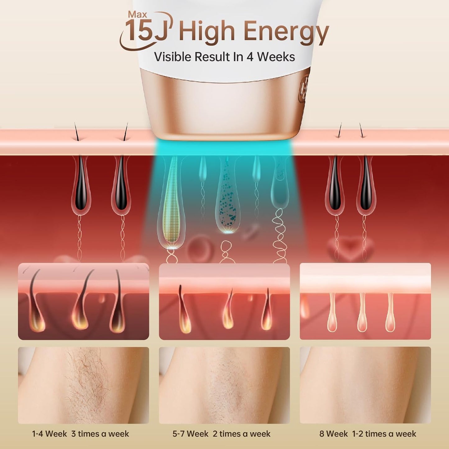 Laser Hair Removal Device for Women & Men – 3-in-1 IPL, 999,900+ flashes, 9 energy levels, painless, at-home use.
